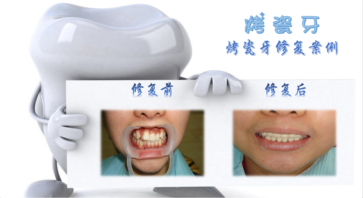 江阳区牙科诊所：守护口腔健康的小卫士